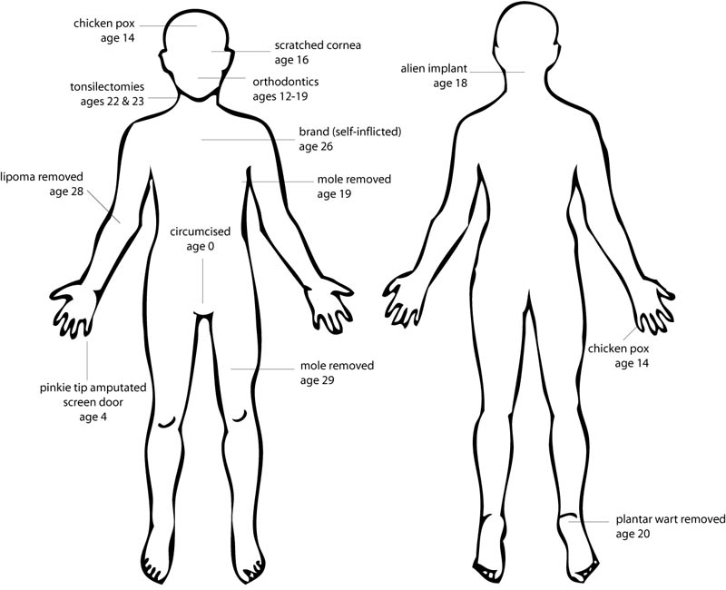 A front-and-back profile of a human male, as one might find on a medical chart, with arrows and labels indicating locations and origins of 13 scarring wounds on my person.